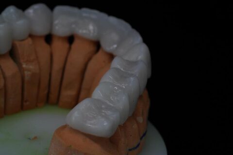 DentalTechnology Lucrări Zirconiu realizate prin frezare CAM