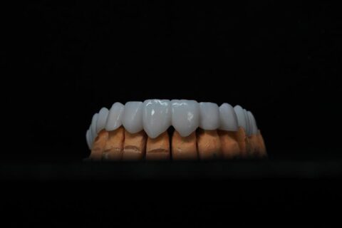 DentalTechnology Lucrări Zirconiu realizate prin frezare CAM