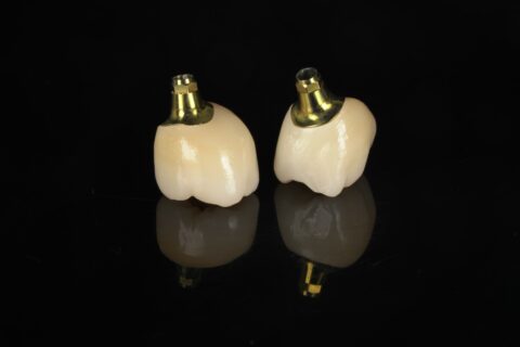 DentalTechology Lucrari Zirconiu realizate prin frezare CAM (1)
